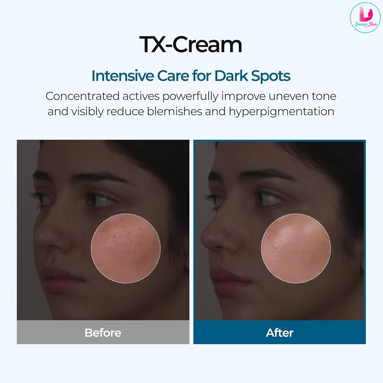 Dr.Melaxin TX Cream 50ml